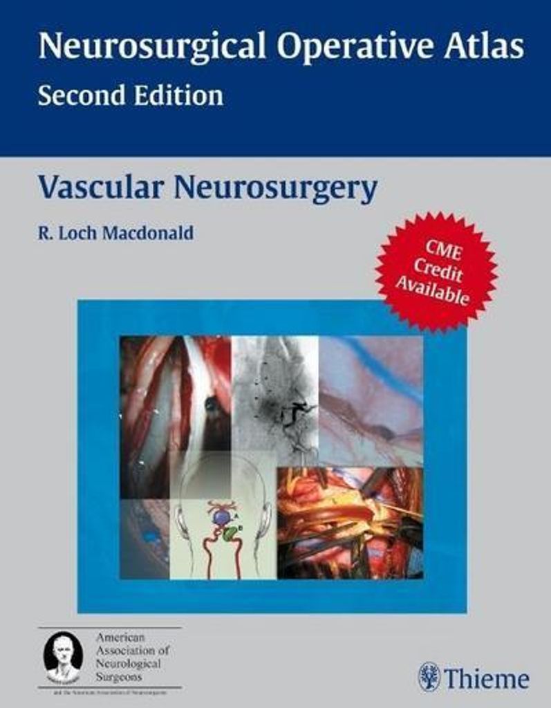 Vascular Neurosurgery