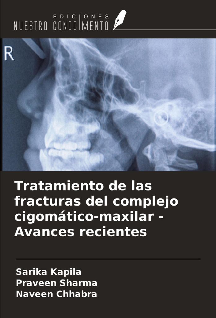 Tratamiento de las fracturas del complejo cigomático-maxilar - Avances recientes