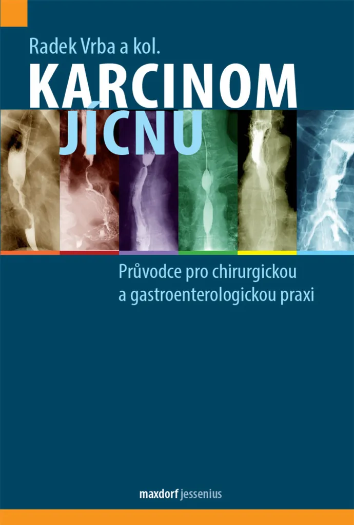 Livre Médical : Traitement du Cancer de l'œsophage et Gastro-entérologie