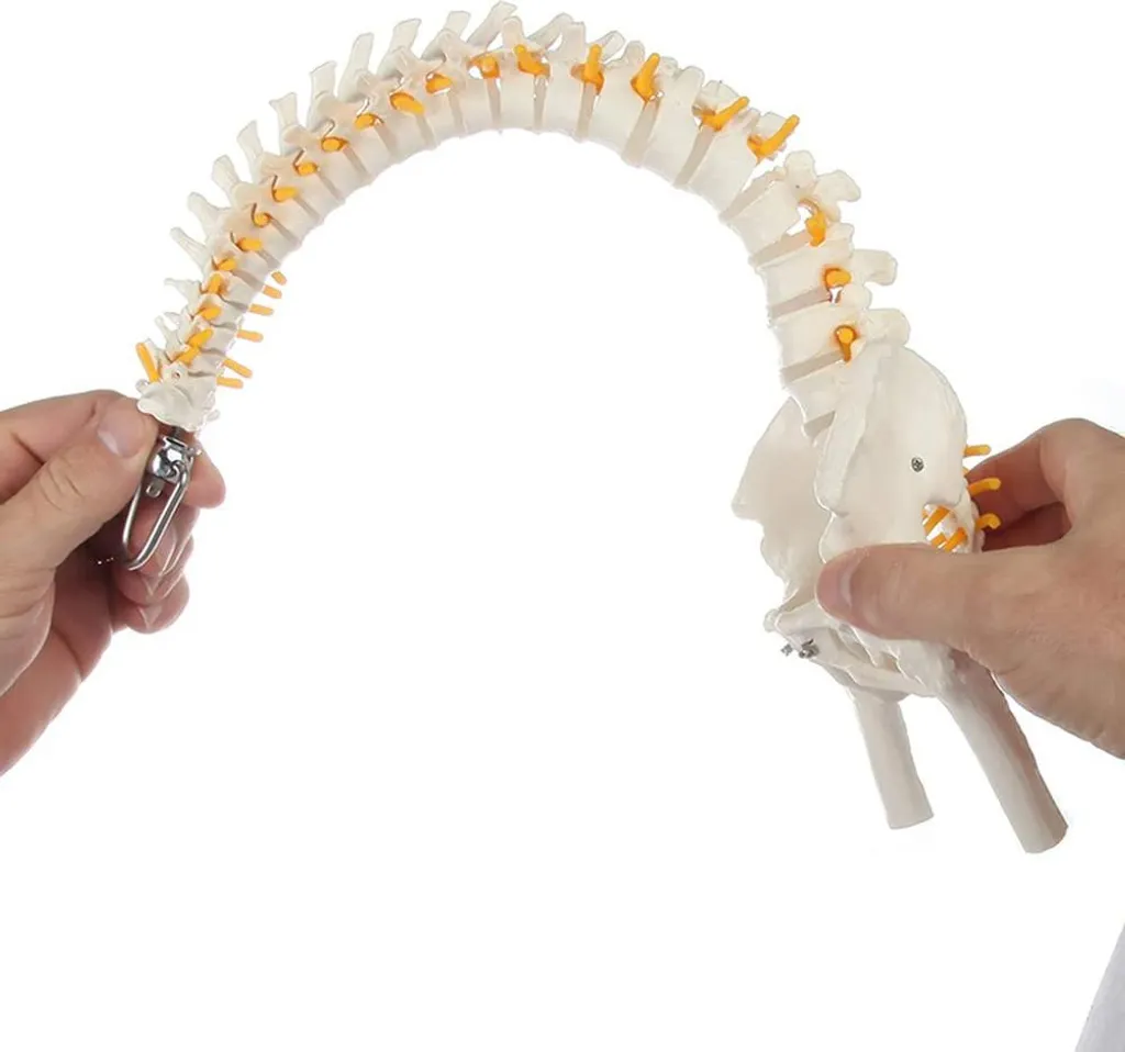 Modèle colonne vertébrale pour expliquer la hernie et sciatique