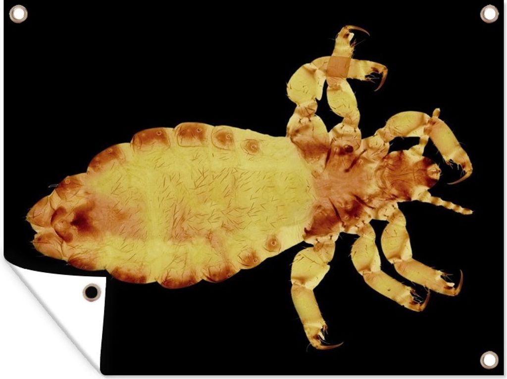 MuchoWow 40x30 cm Outdoor-Poster Gartendeko Sichtschutz Garten Poster für den Garten Mikroskopische Ansichten von Läusen