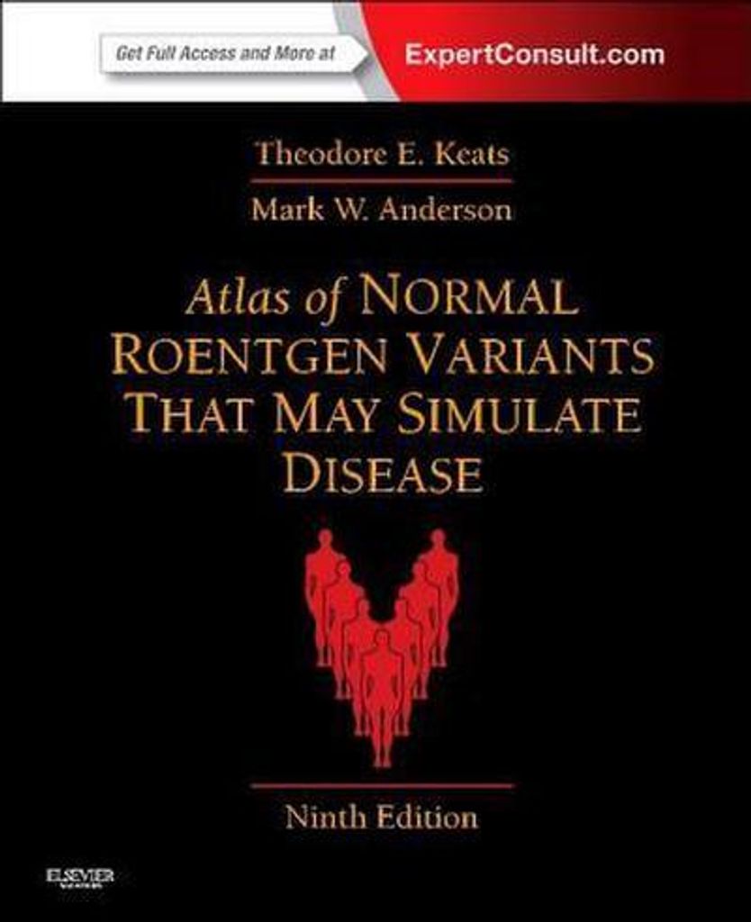 Atlas of Normal Roentgen Variants That May Simulate Disease: Expert Consult - Enhanced Online Features and Print
