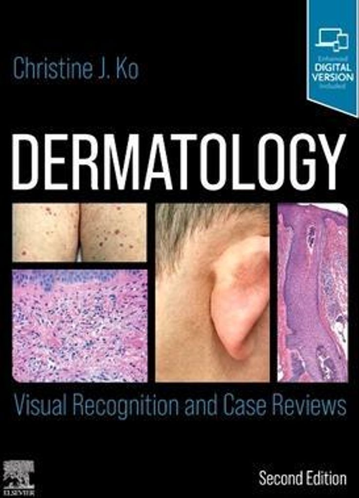 Dermatology: Visual Recognition and Case Reviews