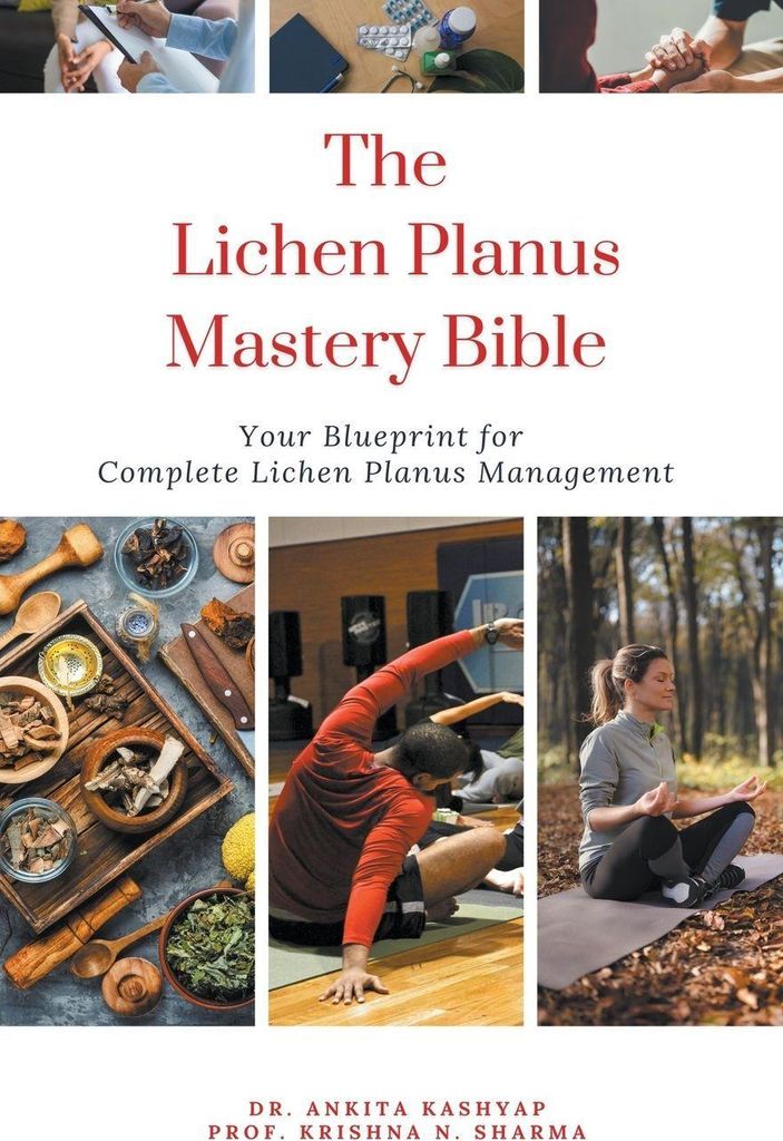 The Lichen Planus Mastery Bible