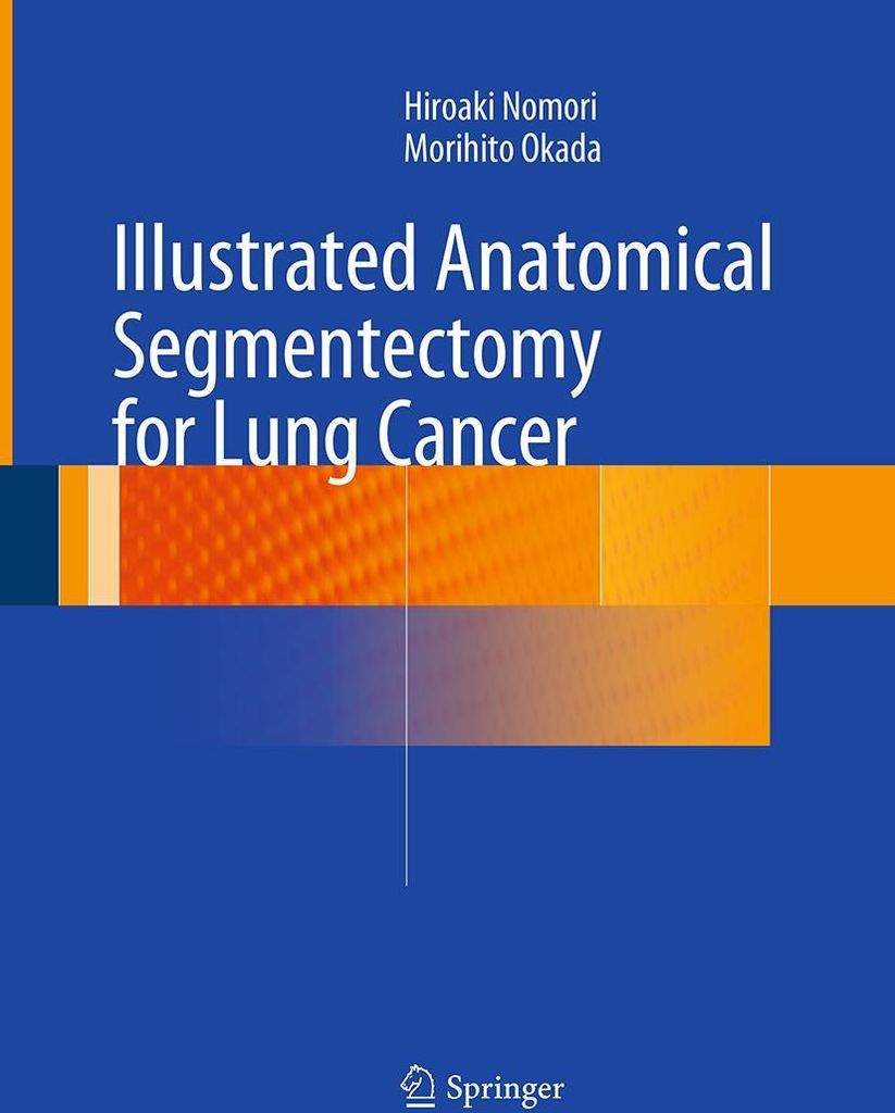 Illustrated Anatomical Segmentectomy for Lung Cancer