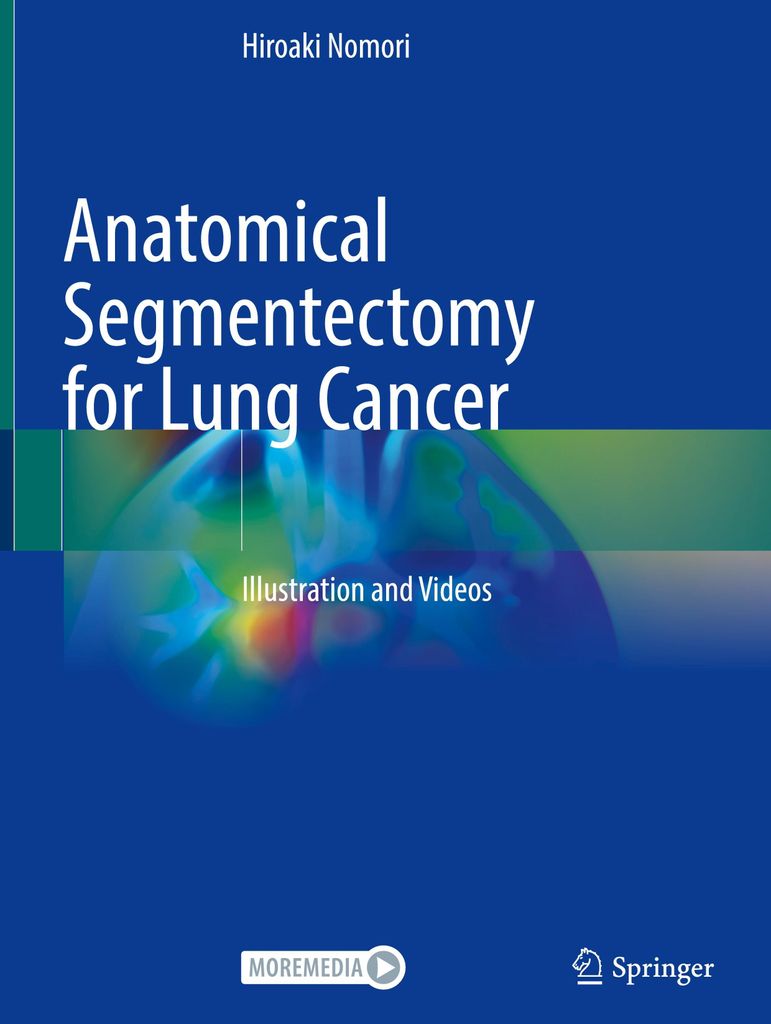 Anatomical Segmentectomy for Lung Cancer