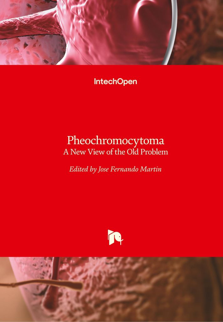 Pheochromocytoma