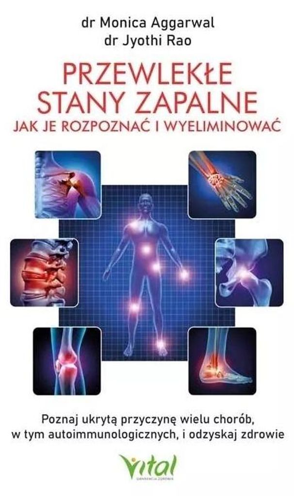 Przewlekłe stany zapalne. Jak je rozpoznać i wyeliminować. Poznaj ukrytą przyczynę wielu chorób, w tym autoimmunologicznych, i odzyskaj zdrowie