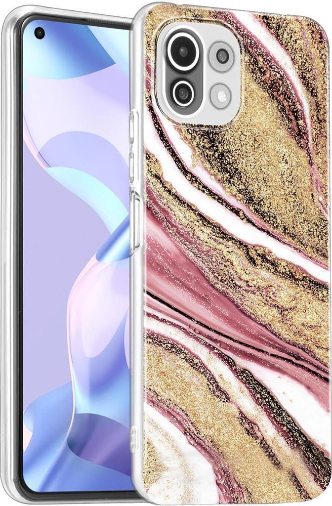 Conie Muster Schutzhülle für Xiaomi Mi 11 Lite 4G/5G Tasche Silikon Case Bild Cover Bumper TPU Hülle als Motiv 2