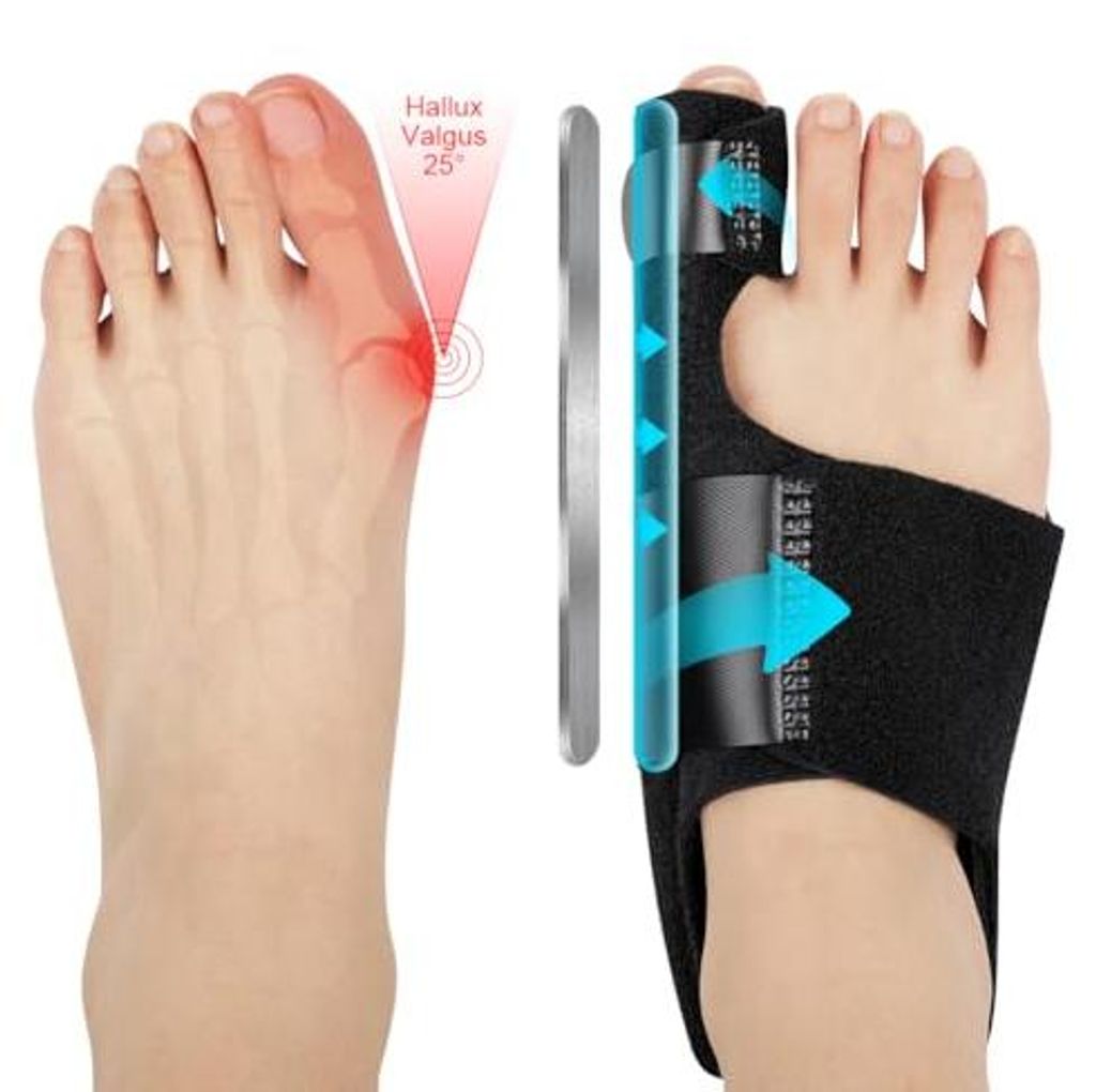 Hallux Valgus Korrektur Schiene, 2 Korrektur Schiene und 2x Produktbild 