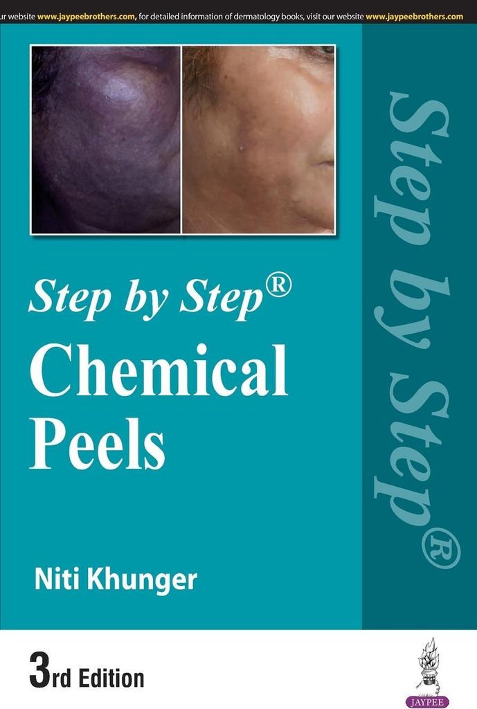 Step By Step Chemical Peels – Lingua: Inglese