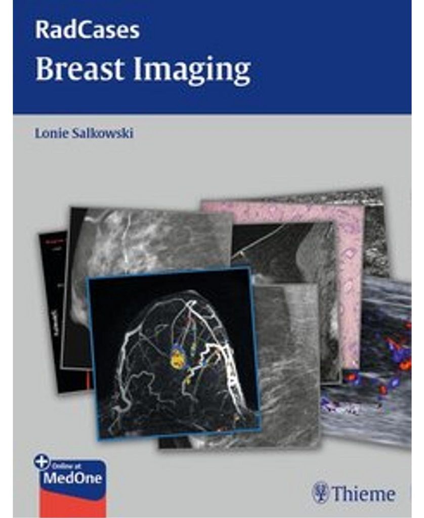 Breast Imaging