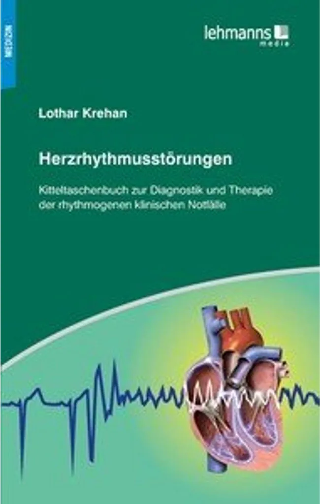 Herzrhythmusstörungen - Détecteur d'arythmie intelligent à haute précision
