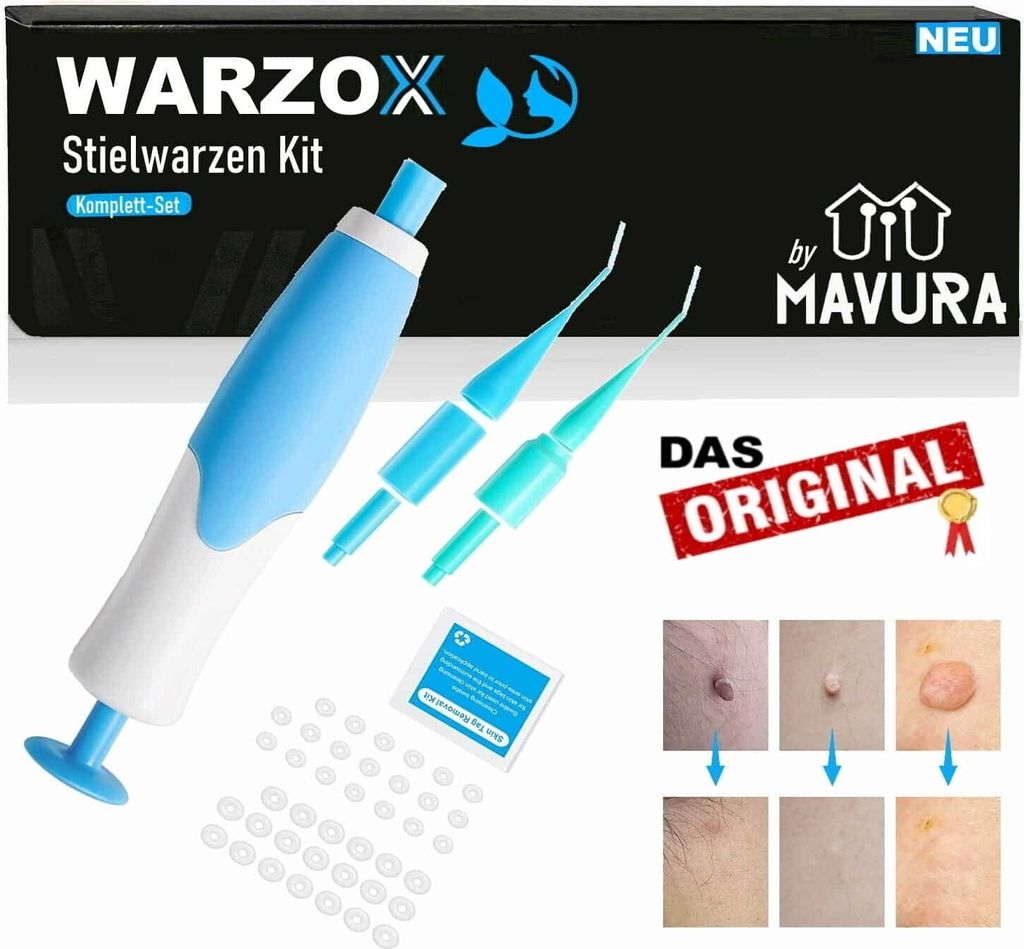 WARZOX Skin Tag Remover Kit Stielwarzen Set Fibrom Kosmetik Entferner 54tlg