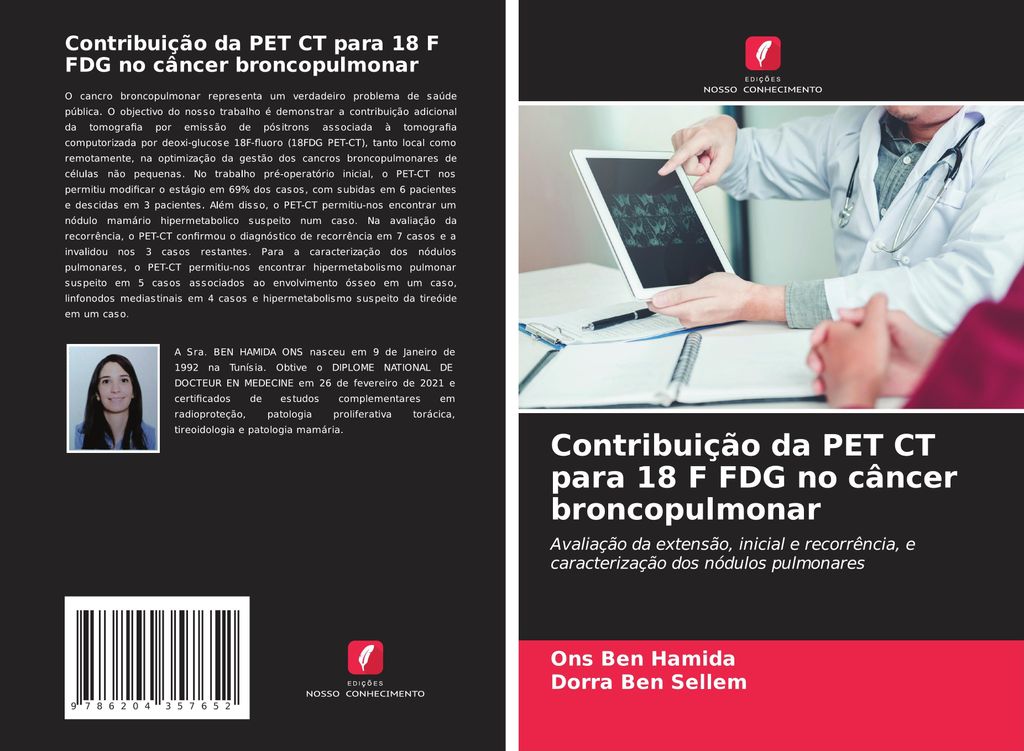 Contribuição da PET CT para 18 F FDG no câncer broncopulmonar