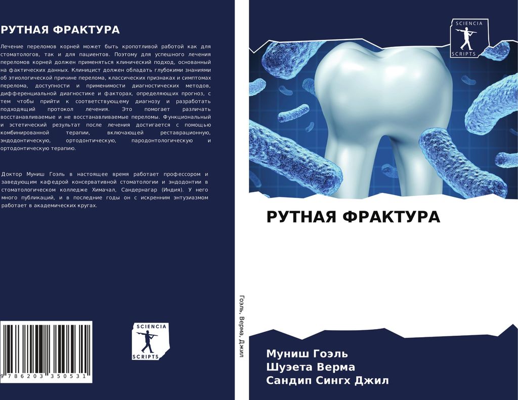 RUTNAYa FRAKTURA