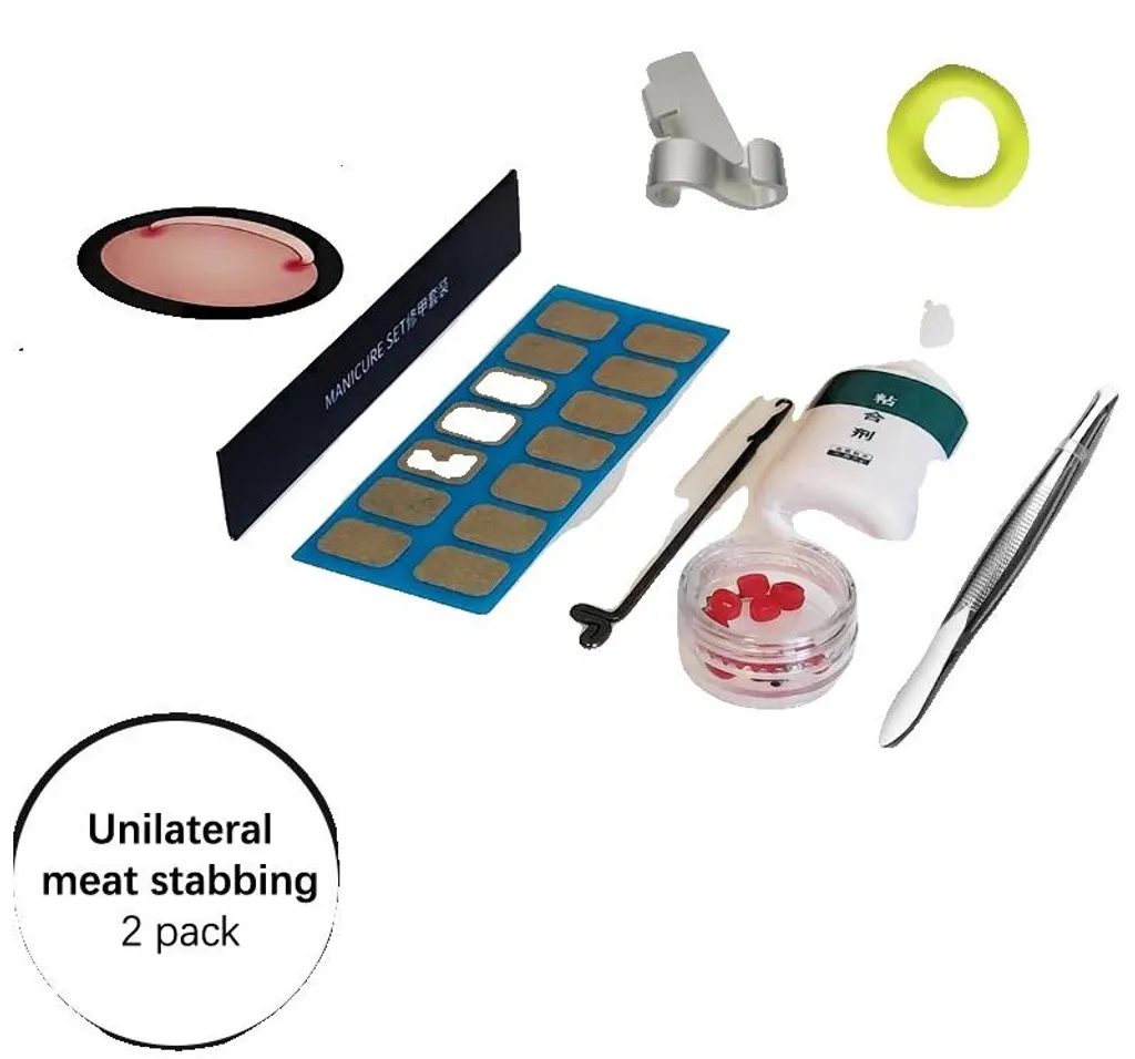 Correcteur d'ongle incarné réglable et portable - Acier inoxydable x2