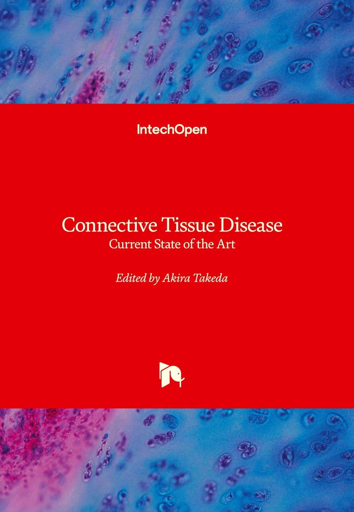 Connective Tissue Disease