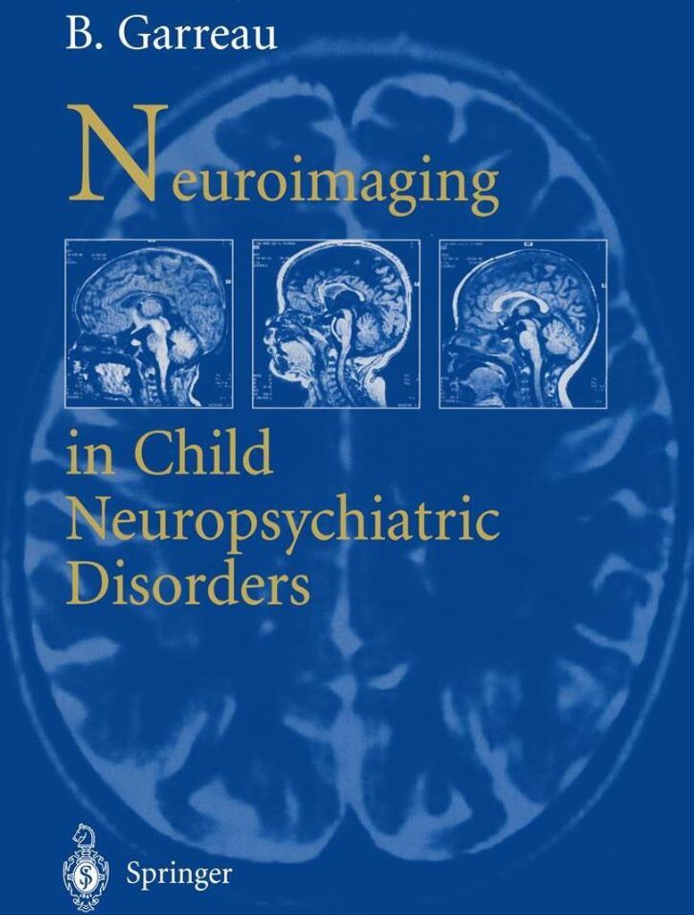 Neuroimaging in child neuropsychiatric disorders