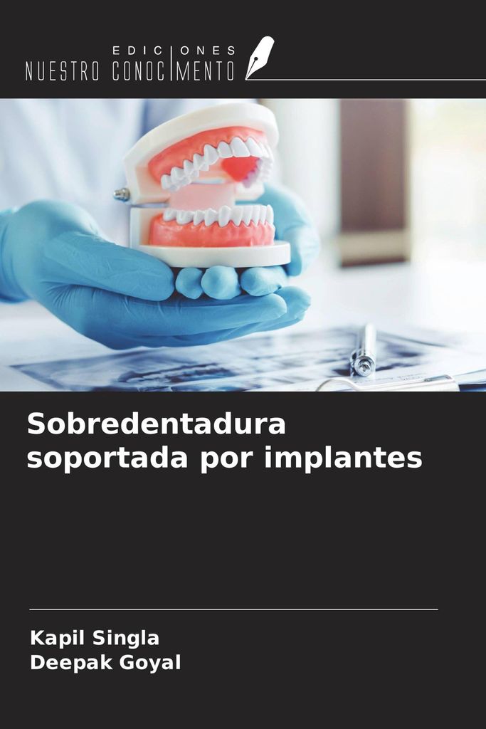 Sobredentadura soportada por implantes