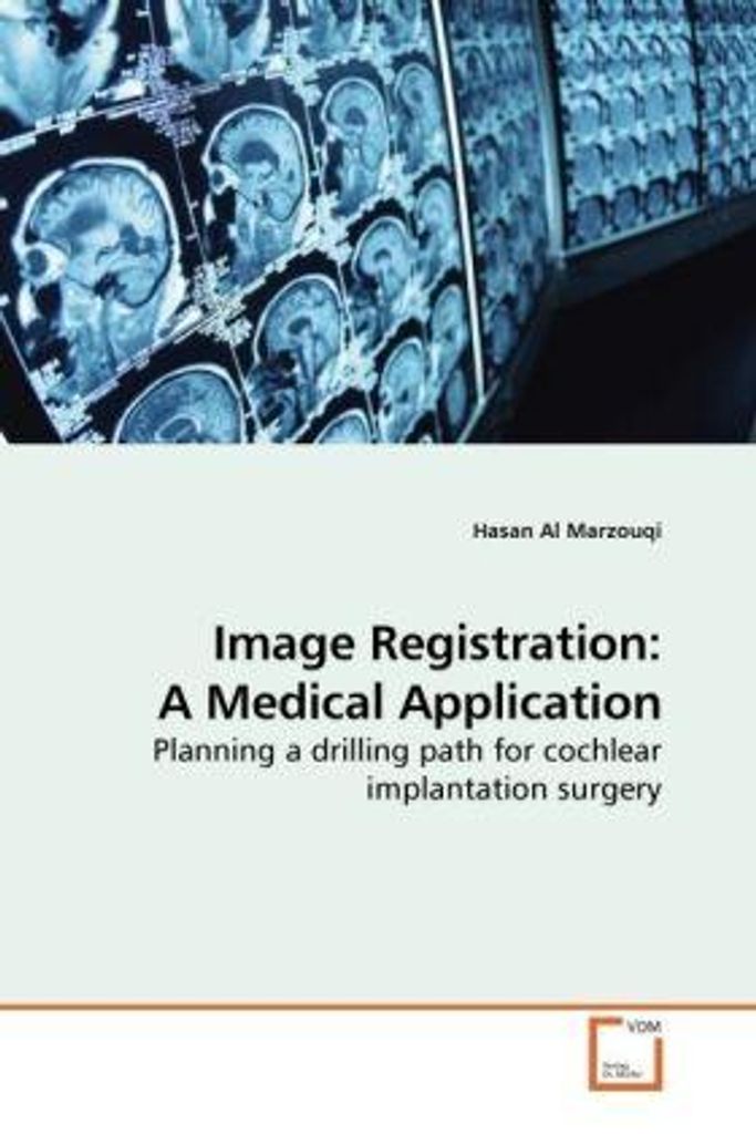 Al Marzouqi, H: Image Registration: A Medical Application