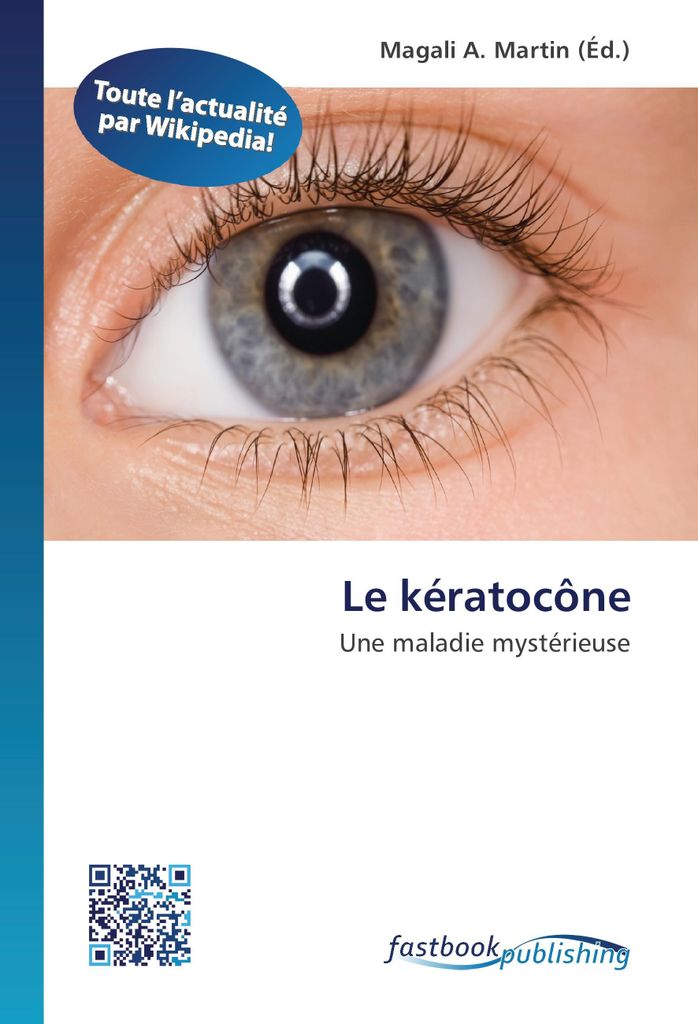 Le kératocône