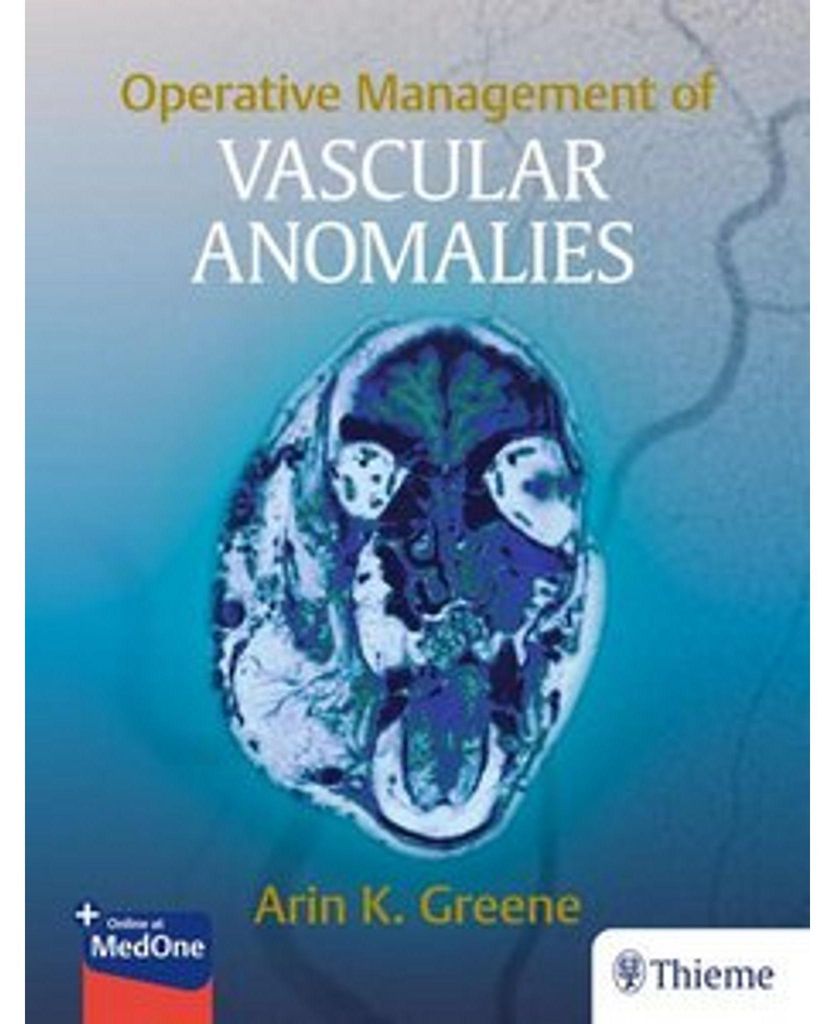 Operative Management of Vascular Anomalies
