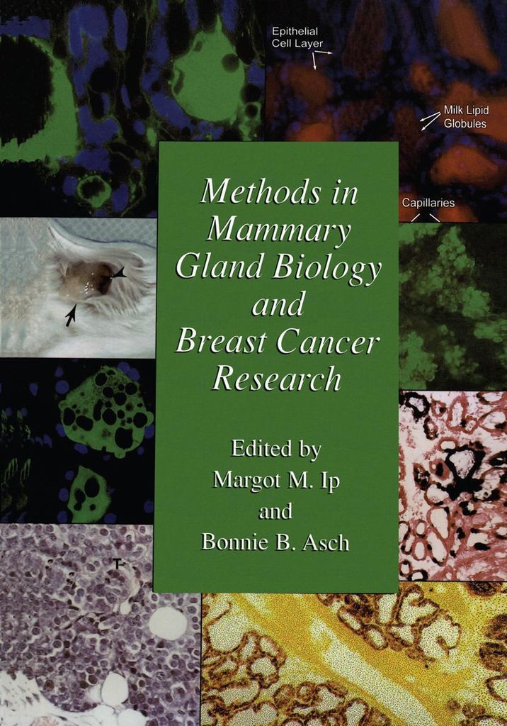 Methoden der Brustdrüsenbiologie und Brustkrebsforschung