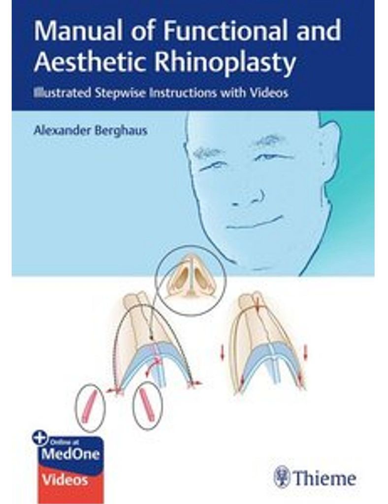 Manual of Functional and Aesthetic Rhinoplasty