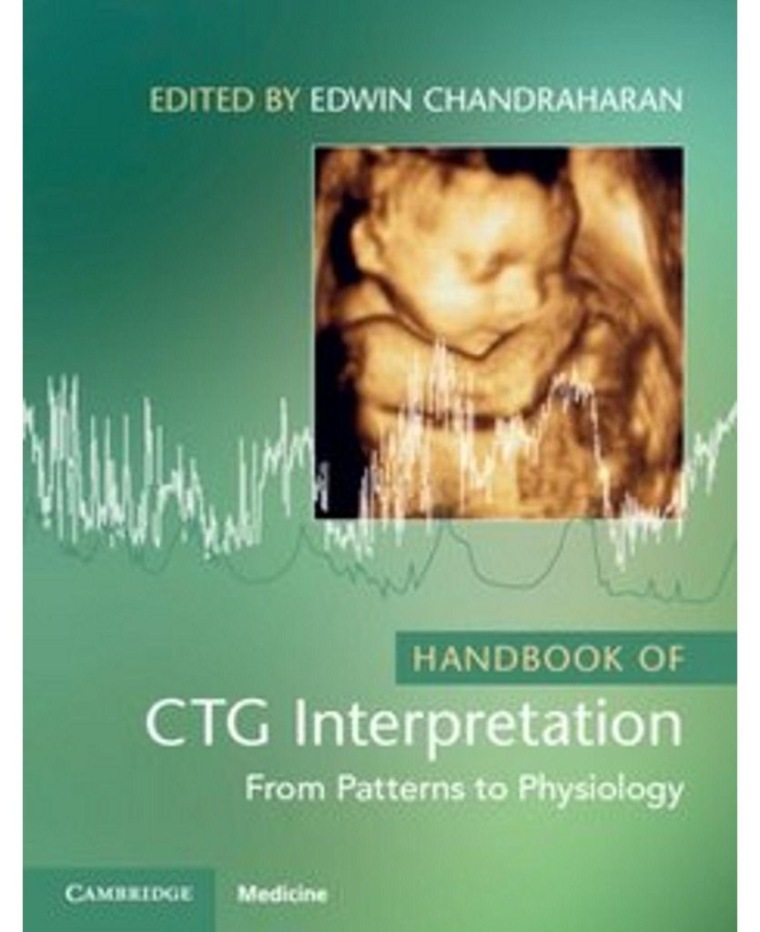 Handbook of CTG Interpretation