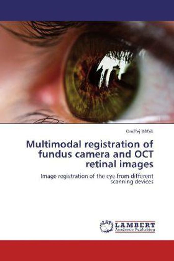 Multimodale Registrierung von Funduskamera- und OCT-Netzhautbildern