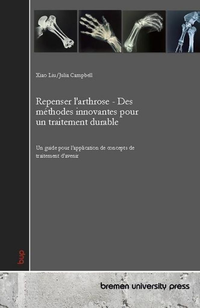 Arthrose neu denken – Innovative Methoden für eine nachhaltige Behandlung