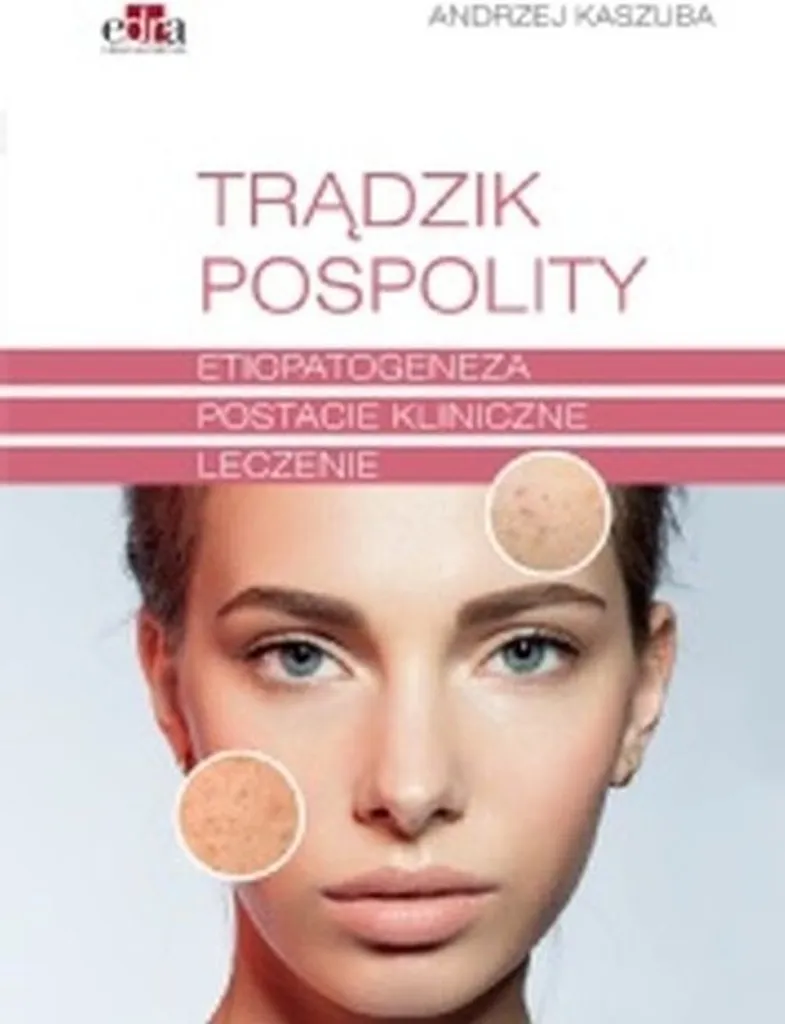 Manuel de Dermatologie : Acné vulgaire A. Kaszuba (Livre polonais)