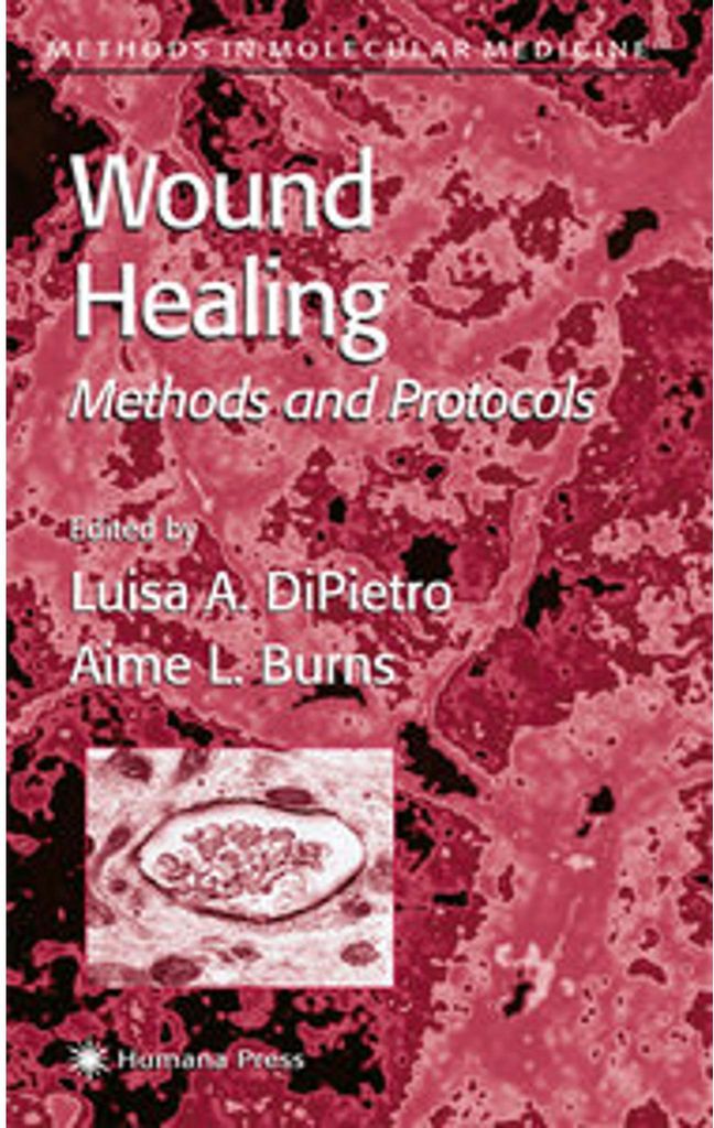 Wound Healing
