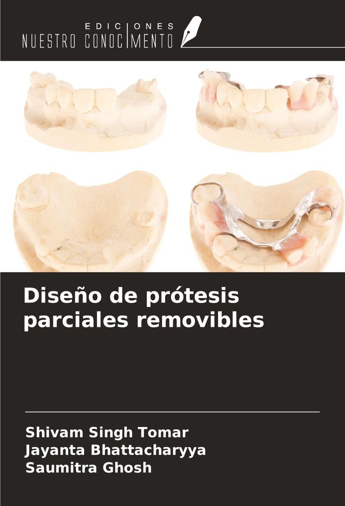 Diseño de prótesis parciales removibles