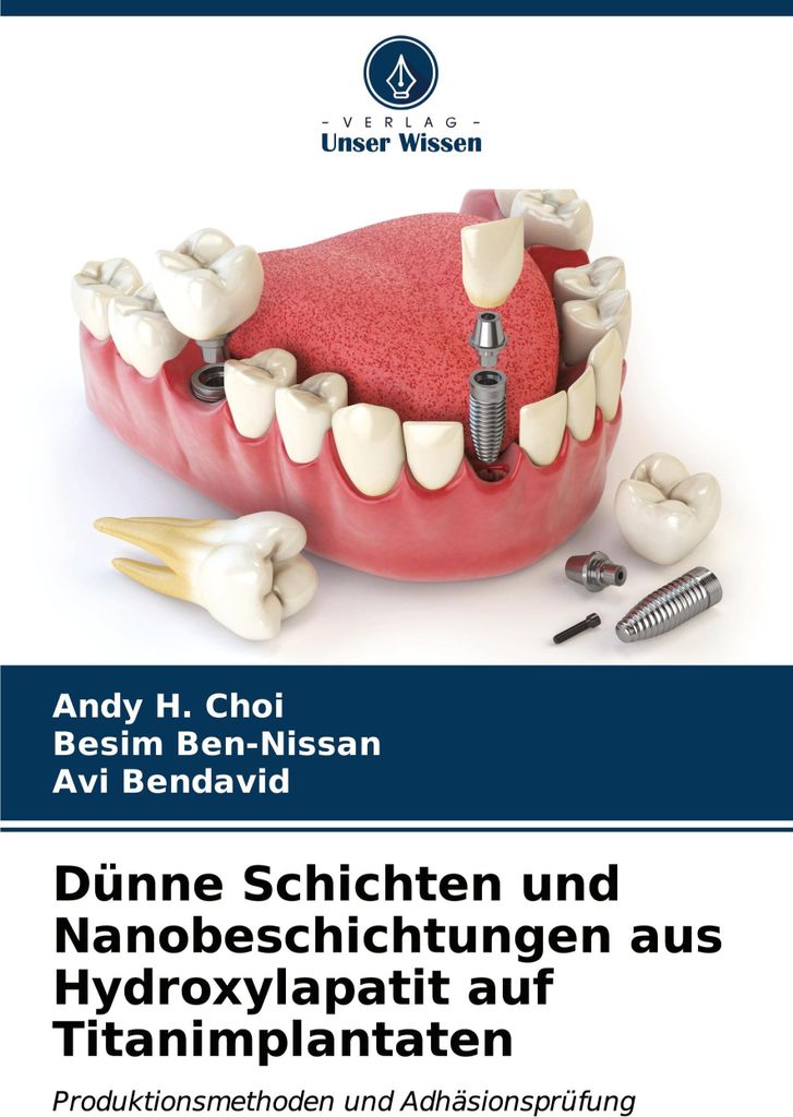 Dünne Schichten und Nanobeschichtungen aus Hydroxylapatit auf Titanimplantaten