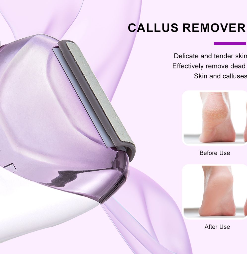 SURKER 3 in 1 Damen-Epilierer Rasierer für Produktbild 3
