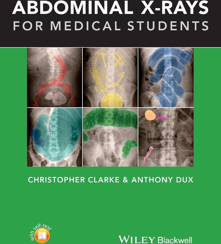 Abdominal X-rays for Medical Students