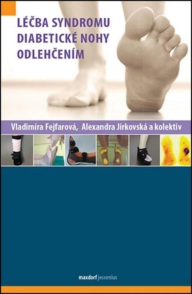 Livre Traitement du Syndrome du Pied Diabétique par Décharge (Collectif)