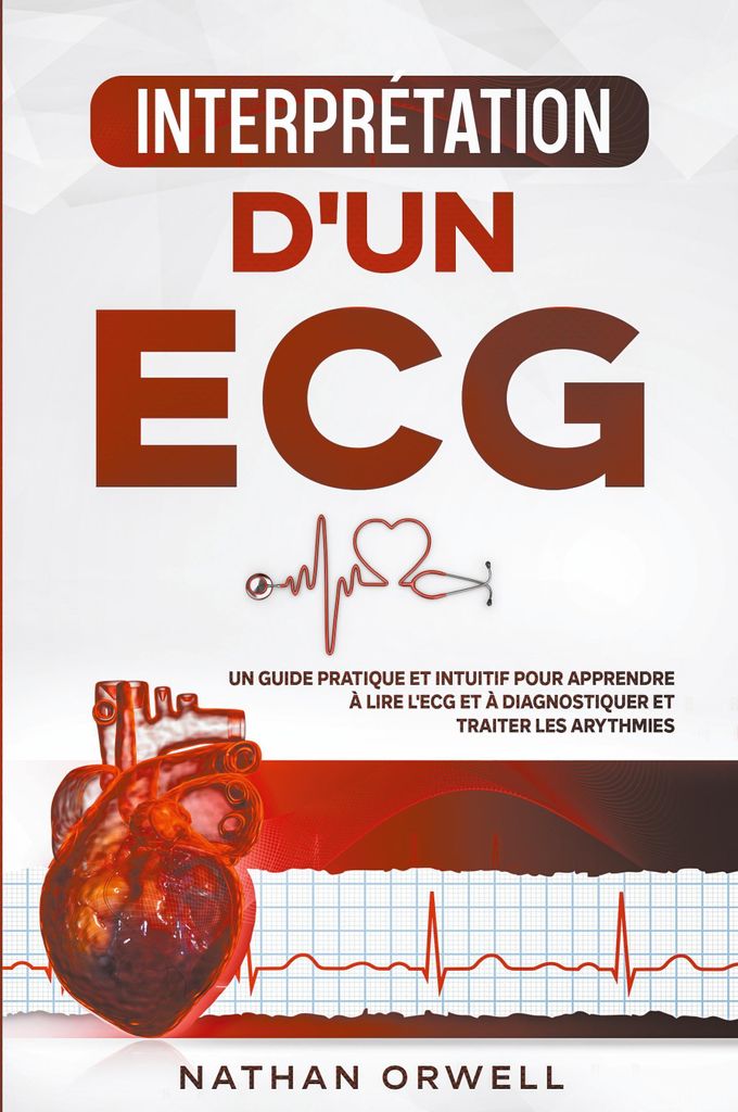 Interprétation d'un ECG