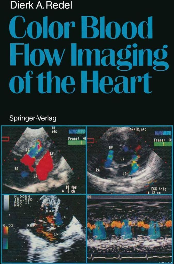 Color Blood Flow Imaging of the Heart