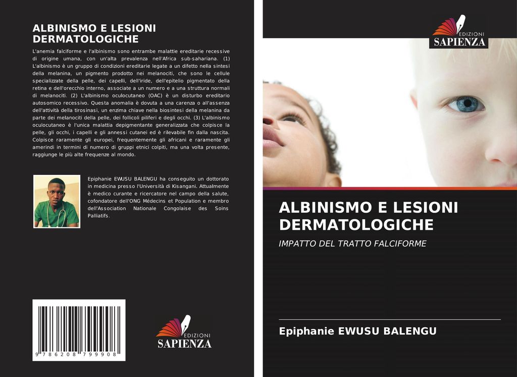 Albinismo E Lesioni Dermatologiche