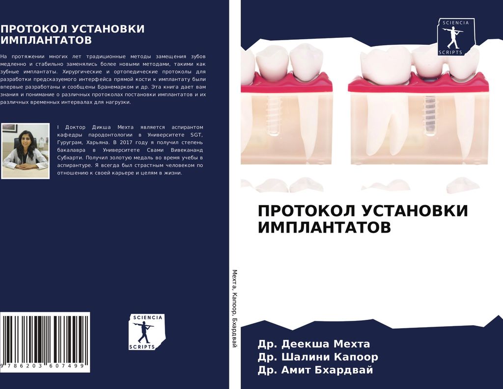Protokol Ustanovki Implantatov