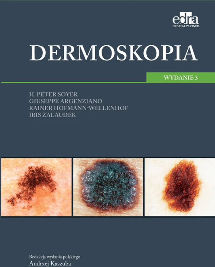 Atlas Dermoskopia illustré en polonais guide de dermoscopie visuel