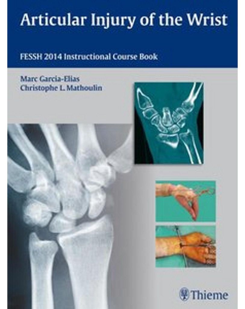 Articular Injury of the Wrist