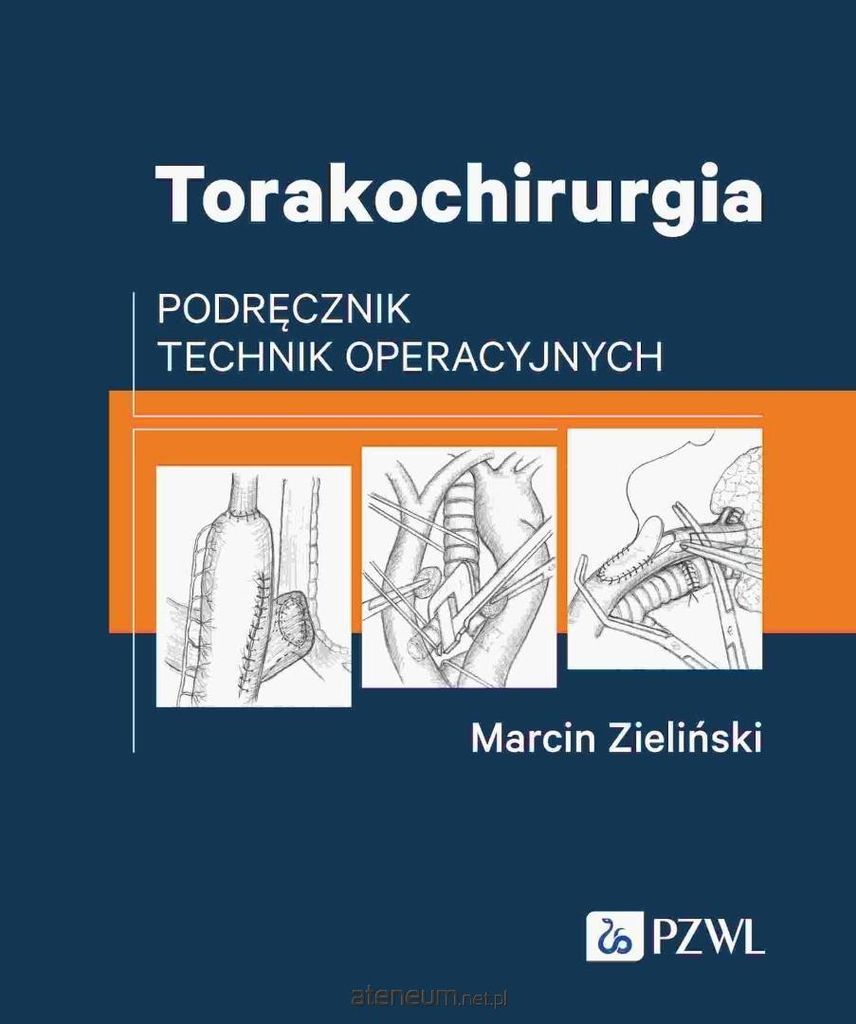 Thoraxchirurgie. Handbuch der Operationstechniken