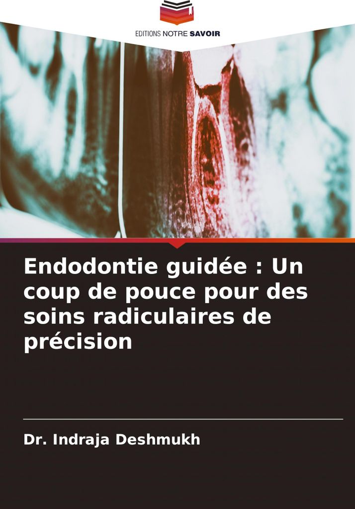Endodontie guidée : Un coup de pouce pour des soins radiculaires de précision