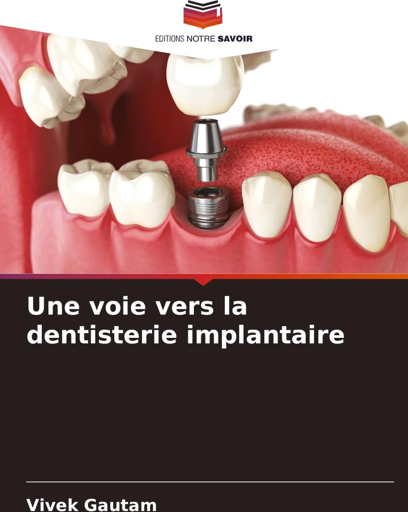 Une voie vers la dentisterie implantaire