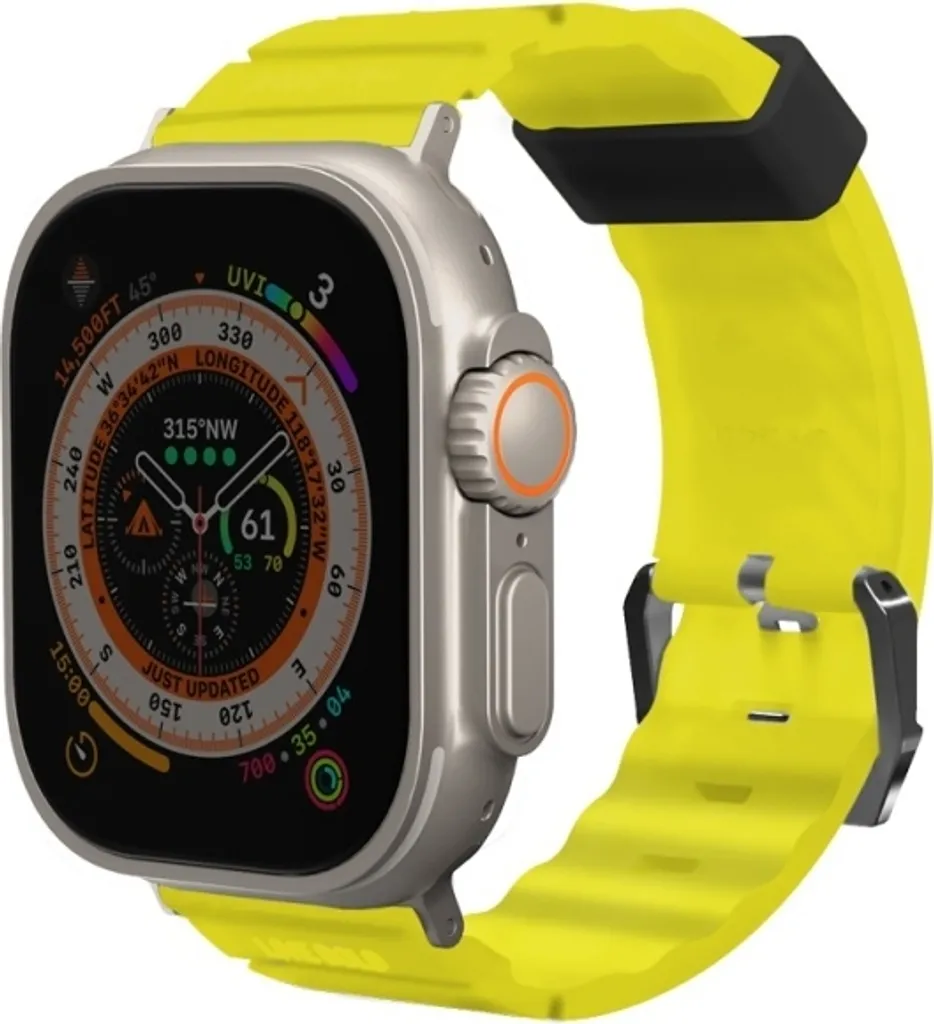 Skinarma Shokku Giallo: Il Cinturino Apple Watch Più Cool del 2024