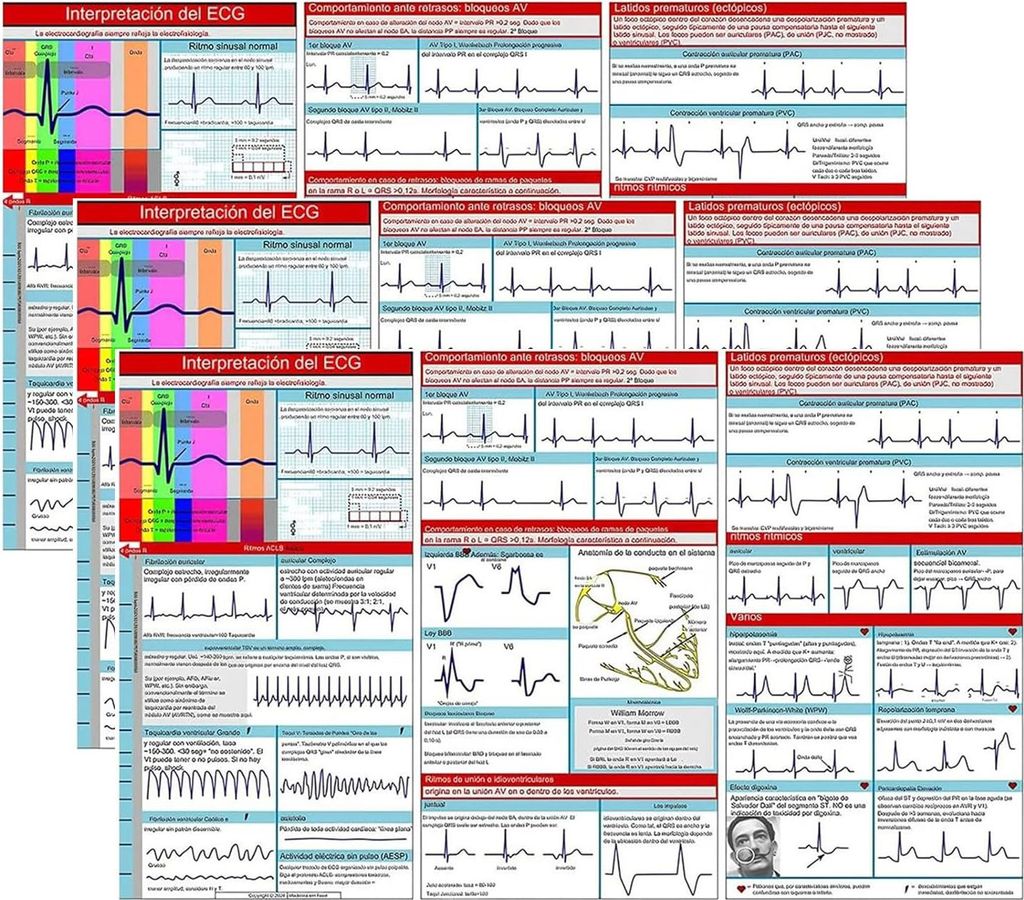 EKG-Taschenleitfaden, EKG-Rhythmusinterpretation, doppelseitige Taschenreferenzkarte, dreifach faltbares Studienbuch für Studenten und Pflegekräfte